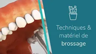 Comment utiliser les brossettes interdentaires ?