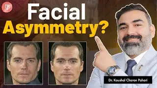 Facial Asymmetry: Can It Be Corrected? | Causes & Treatments | Dr. Kaushal | SB Aesthetics