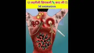 छिपकली के कटने से हुआ infection #asmr #youtubeshorts #shorts @BrainzFacts