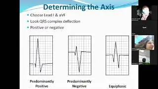 ECG MADE EASY DAY-2 Part-1 Live Zoom Session by Dr.Sairah Sadaf 6th Feb 2024