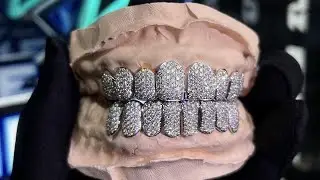 DM us for more details, and let’s get you fitted! 😎🔥 #grillzdesign #customgrillz #jewelry