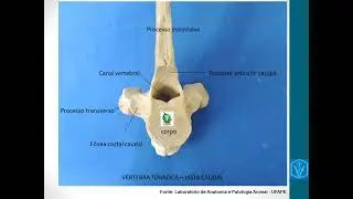 Osteologia Da Coluna Vertebral | Parte 02 | Vértebras Torácicas, Lombares e Osso Sacro