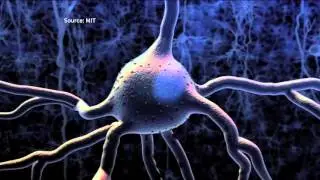 Sound Waves Give San Diego Neuroscientists Control Over Brain Cells