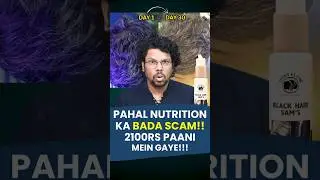 Pahal nutrition scam | Black Hair Sam's | Hair Loss | Hair Growth | Pre mature greying scam |