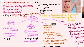 Erythema Multiforme Oral Pathology