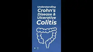 Understanding Crohn's Disease & Ulcerative Colitis | #shorts