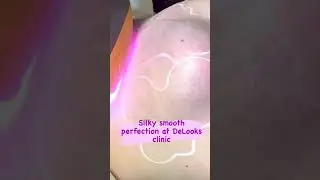 Laser Away Chin Hair With Delooks Clinic: The Ultimate Solution!