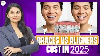 Teeth Straightening Cost 2025 | Braces vs Aligners | Dr. Srishti Bhatia #dentist #dentaltreatment