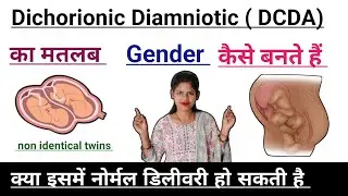 Dichorionic Diamniotic twins pregnancy me normal delivery ho sakti hai ya nhi Dcda twins pregnancy