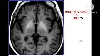 T1W IMAGE
