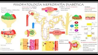 Fisiopatología de Nefropatía Diabética