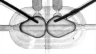 Lipid bilayer in a microfluidic trap