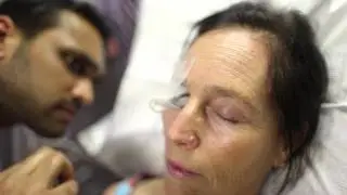 Lipiflow performed by Chirag Patel, MD