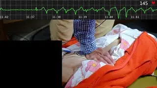Visible irregular female heartbeat under strong pressure