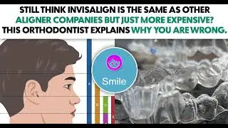 Is Align Technology Superior to Other Aligner Companies?