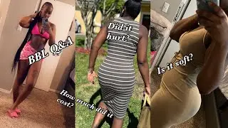 BBL VLOG | BBL Q&A| WHAT WAS THE COST??| RECOVERY HOUSE| MASSAGES| WHERE DID I STAY?