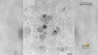 U.S. declares monkeypox outbreak a public health emergency