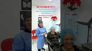 Lifting Facial Sin Cirug&iacute;a | BeyondLift&eacute;&trade; en Miami #beyondhealthmedspa