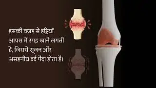 Joint supplements
