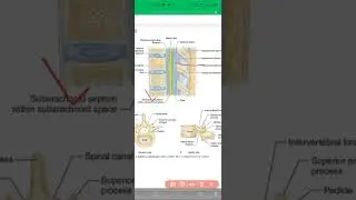 Spinal Anesthesia Morgan and atkinhead Book points