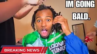 So I'm 20 and Balding... (GOODBYE LOCS)