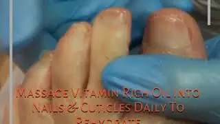 Suffering From Brittle Nails & Dry Cuticles?