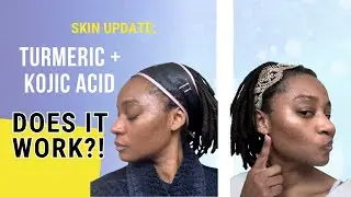 Turmeric + Kojic Skincare Routine 2024: Actual Results