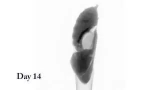 X-ray Scan of Developing Butterfly Chrysalis