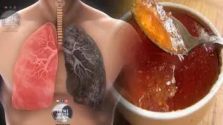 Receta m&euml; e fort&euml; q&euml; ndalon menj&euml;her&euml; dhimbjen e stomakut dhe ndalon koll&euml;n vetem me dy perberes