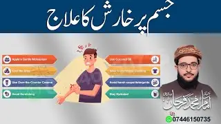 Body Itching Treatment at Home | Natural Remedies for Skin Itch Relief