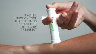 Bug Bite Thing Suction Tool, Poison Remover - Bug Bites and Bee/Wasp Stings, Natural Insect Bite
