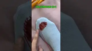 Don&rsquo;t Throw Socks Away! Easy Repair Hack That Saves Money 🧦
