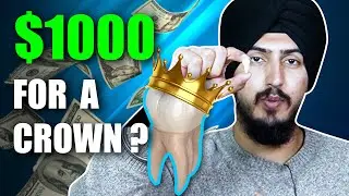 Are Dental Crowns Worth The Money?