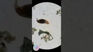 WATER BEAR UNDER THE MICROSCOPE/ MICROORGANISMS/