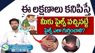 ఈ లక్షణాలు కనిపిస్తే మీకు పైల్స్ వచ్చినట్టే  |  Dr Ramakrishna Chanduri | Nuticos Health Care