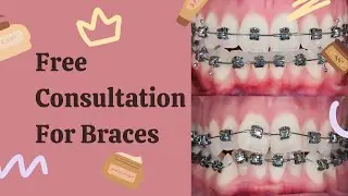 FREE Consultation | Get the best Braces in Multan here