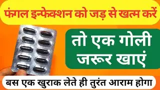 सिर्फ 1 कैप्सूल सालो पुराने दाद खुजली खत्म करे|fungal infection treatment medicine