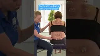 Dry Cupping and Spinal Flexion & Extension technique