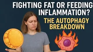 Your Immune System on Obesity: Friendly Fire, Powered by Autophagy Failure