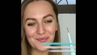 Transform Your Smile in 60 Seconds with Ultrasonic Tooth Cleaner!