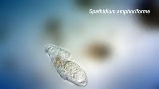 Spathidium amphoriforme