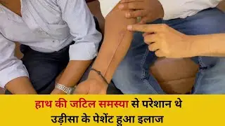 हाथ की जटिल समस्या से इस  तरीके से परेशान थे उड़ीसा के पेशेंट केवल मिला जयपुर आकर मिला  हल