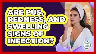 Are Pus, Redness, And Swelling Signs Of Infection?