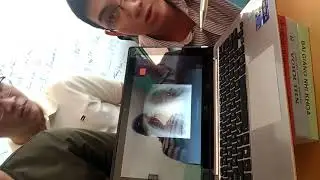 X quang TBS