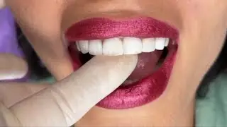 Face Teeth Lips Close Up 💋#SmileMakeover