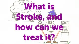 Minute Lectures: What is Stroke, and how can we treat it?