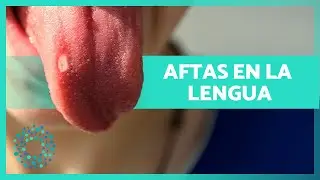 &iquest;Por qu&eacute; tengo LLAGAS en la LENGUA? 👅 Causas y C&oacute;mo se Curan