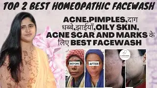 2 BEST HOMEOPATHIC FACE WASH।।For Acne Pimples Pigmentation।।Get Fresh and Glowing skin naturally।।