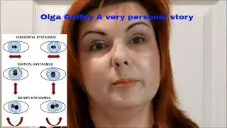 Olga Guffey A very personal story Optic Nerve Hypoplasia and Nystagmus