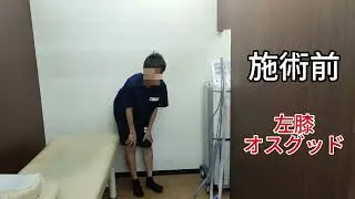 オスグッド施術　beforeAfter①
